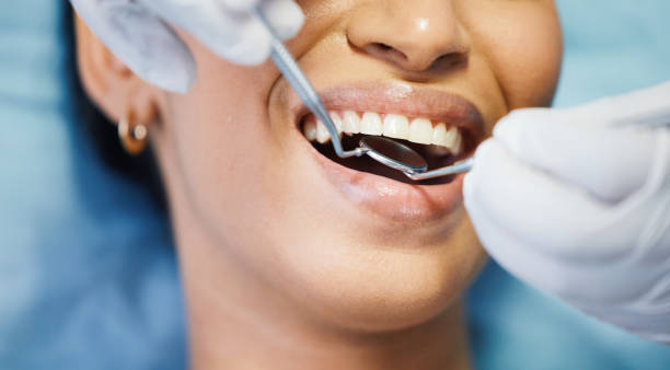 Fast & Reliable Emergency Dental Services in MD